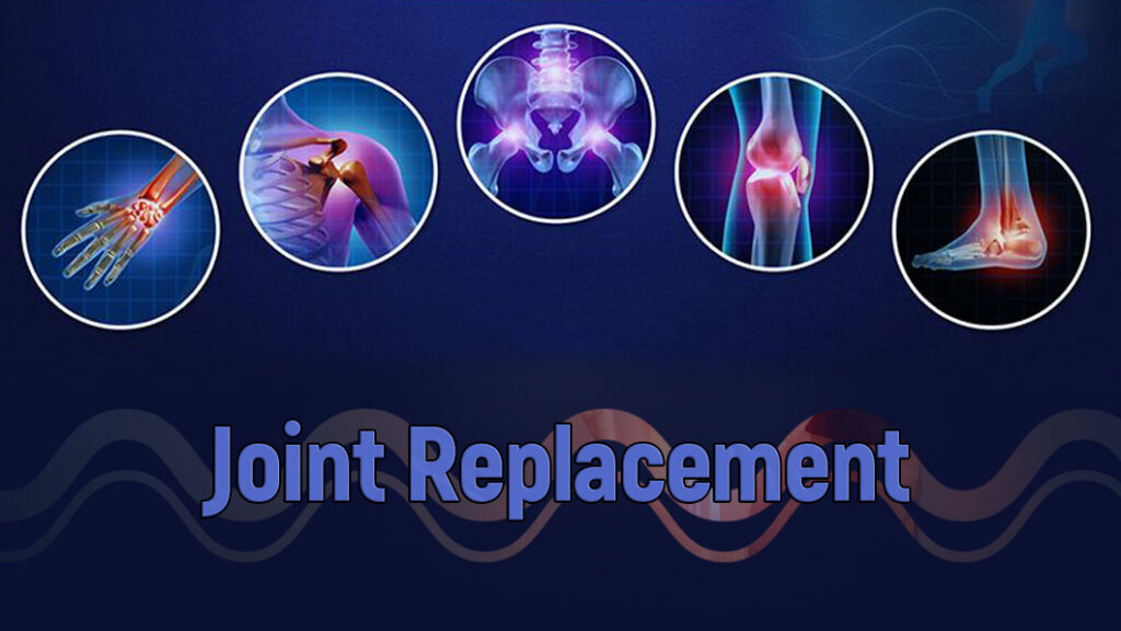 Joint Replacement Surgeon in Shivaji Nagar